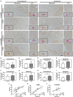 Tau Isoform-Driven CBD Pathology Transmission in Oligodendrocytes in Humanized Tau Mice